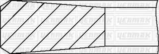 Segman (0,50 Farkli 80,00mm) M41 D17 (174t1) M51 D25 Yayli E36 Range Rover Ii 25 6t Opel X 25 Dt X 2